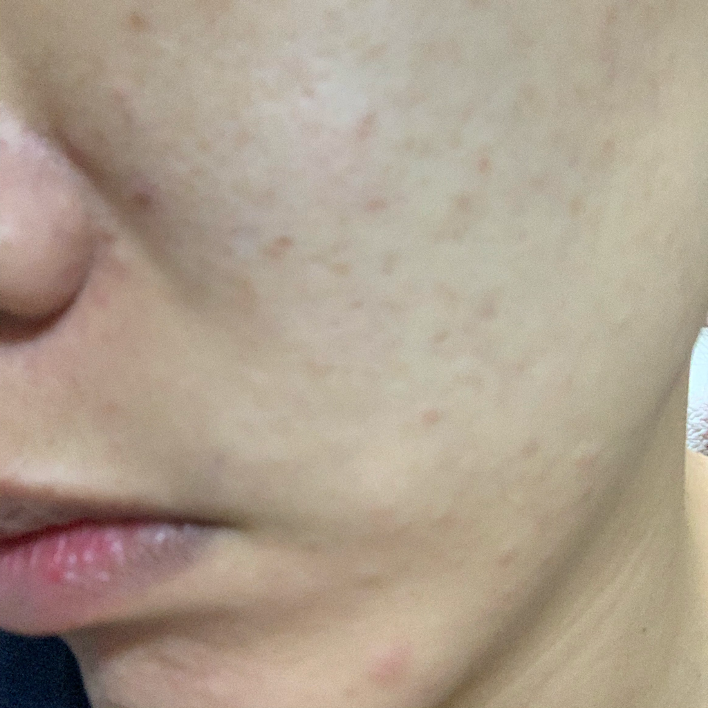 리바이포유 (Rbfy) AC 그린 라인 크림 review image