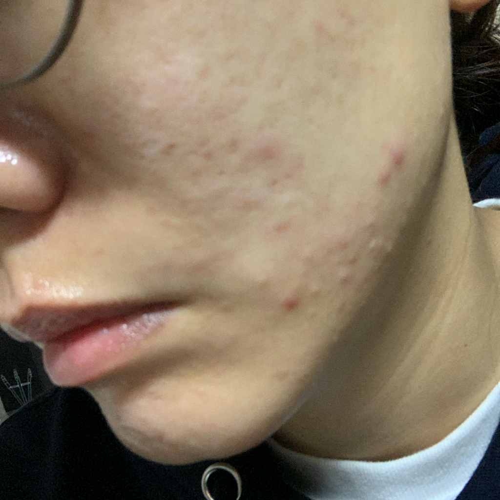 리바이포유 (Rbfy) AC 그린 라인 크림 review image