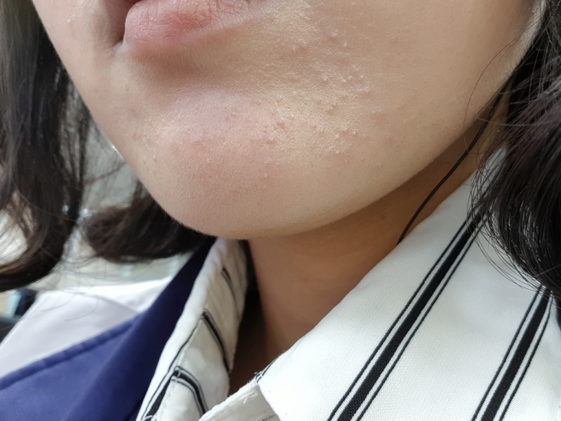 키로 (KIROCOS) 히아루론산 모이스춰 에센스 review image