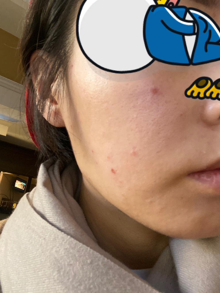 Real user review photo of Vegan Squalane Face Oil