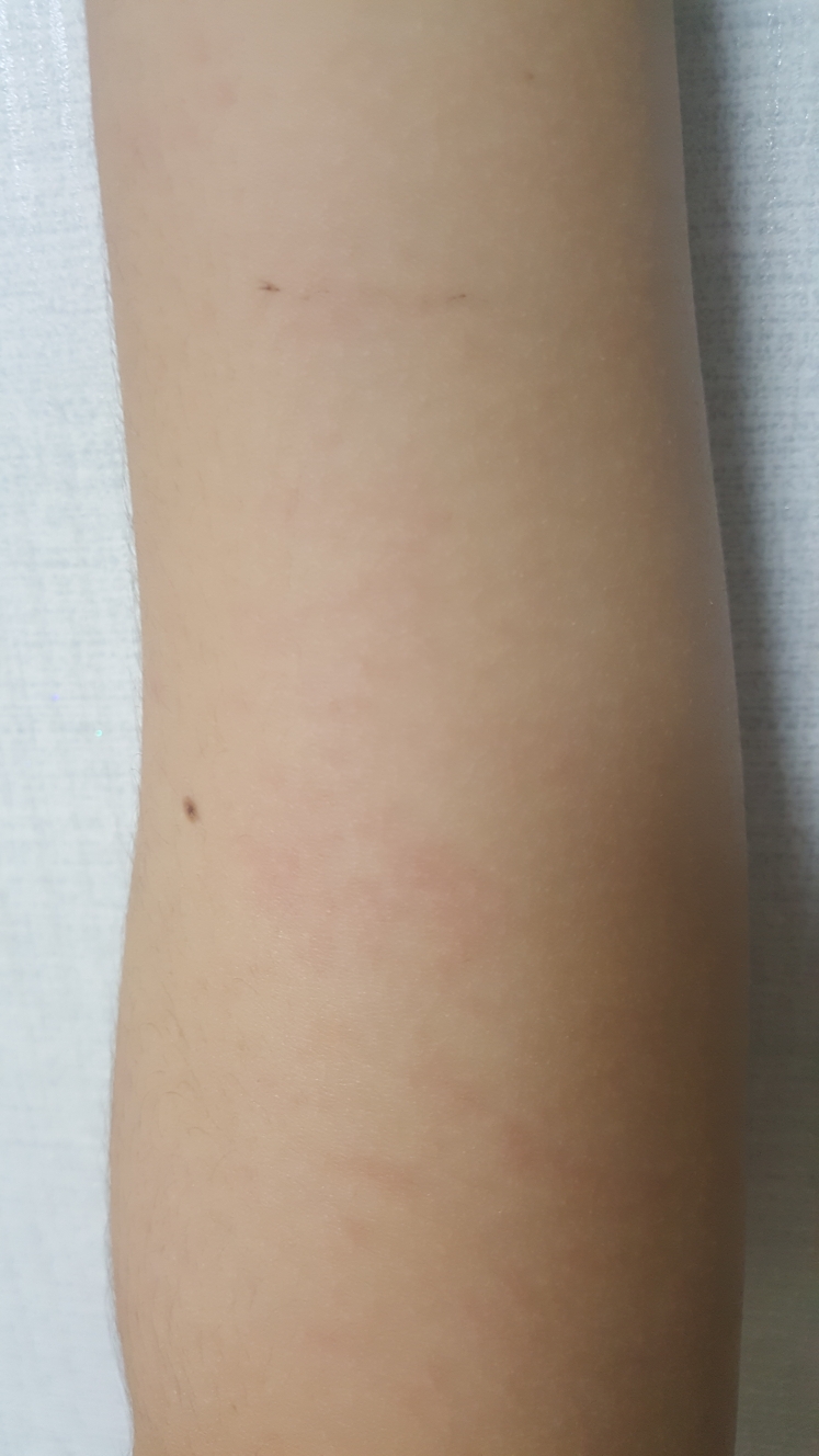 ISAKNOX Turnover 28 Advanced Water Gel Cleansing Lotion review image