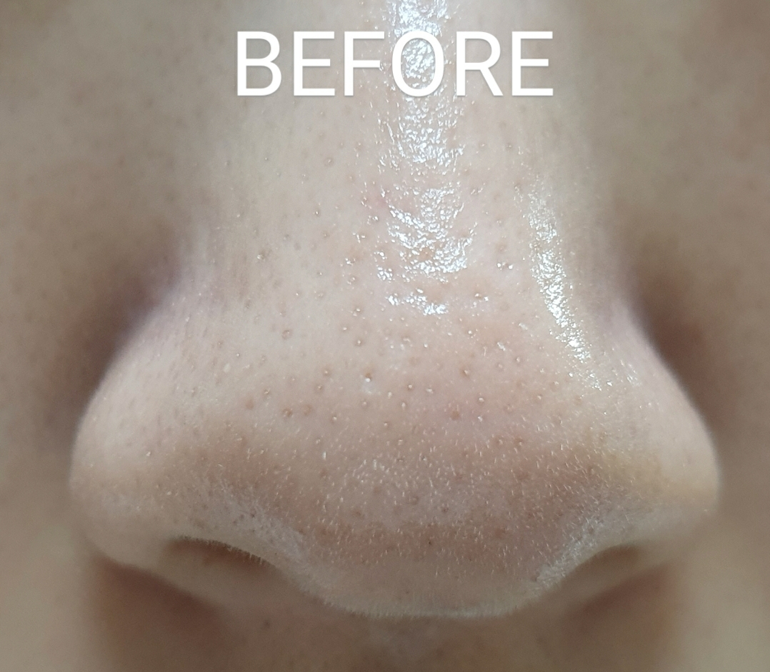 Real user review photo of Titu Serum