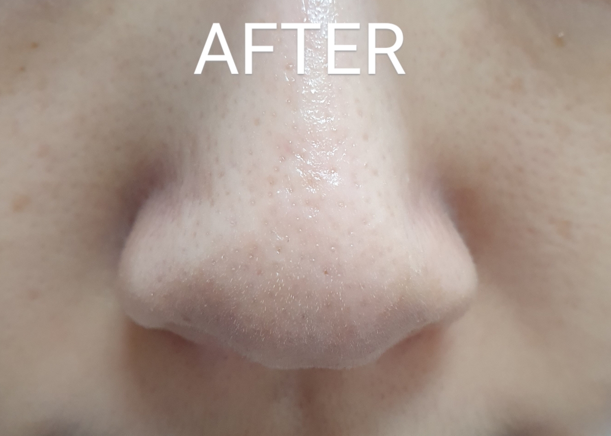 Real user review photo of Titu Serum