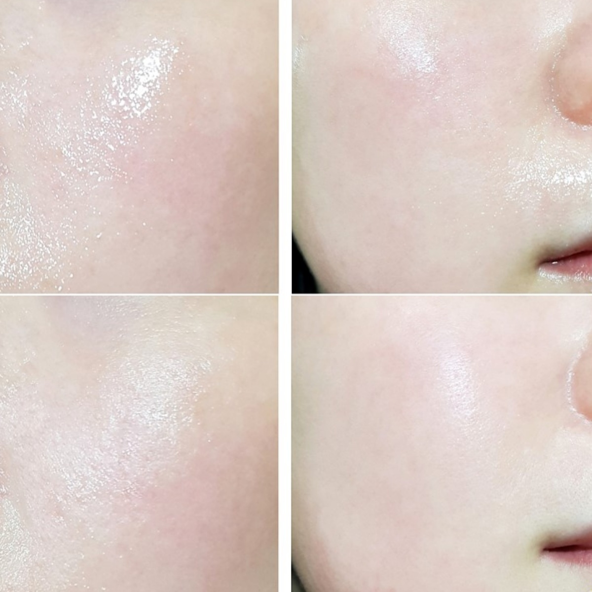 뷰티영 (Beautyoung) 미스틱블루 에너지 수분세럼 review image