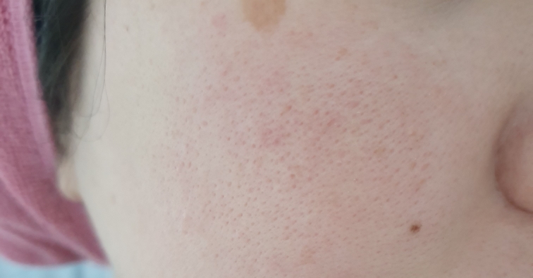 抗干燥强化爽肤水的真实用户使用照片