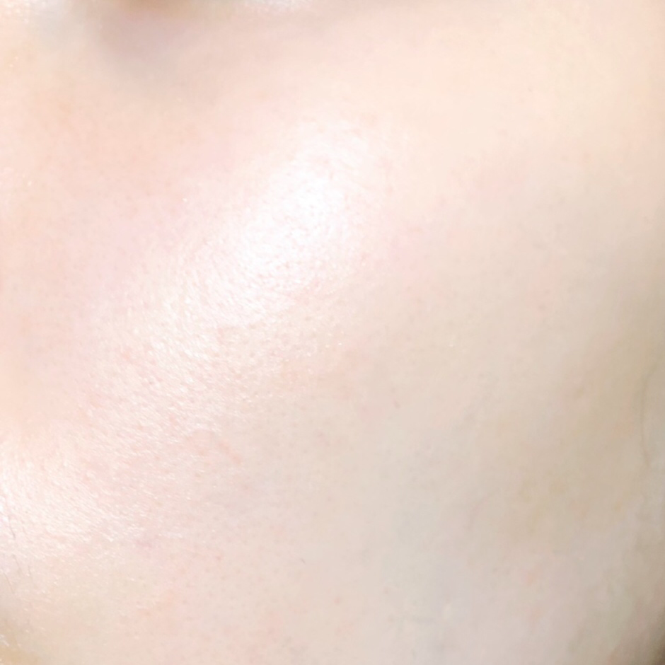 세라클리닉 (CERACLINIC) 더마이드 4.0 인텐시브 크림 review image