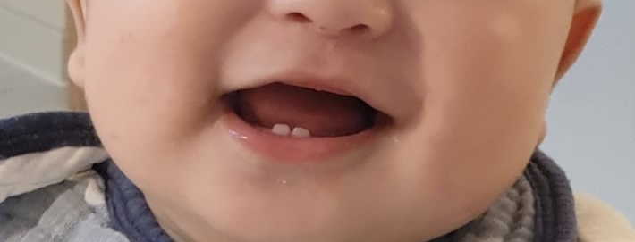 婴儿鹿奶油的真实用户使用照片