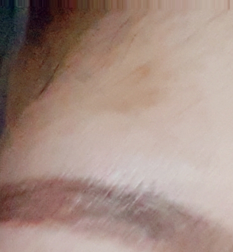 Real user review photo of Blemish Patch