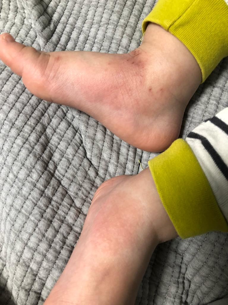 婴儿鹿奶油的真实用户使用照片