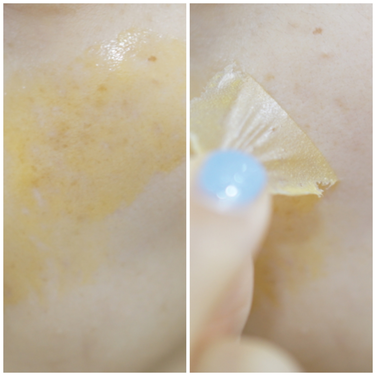 Real user review photo of Blemish Patch