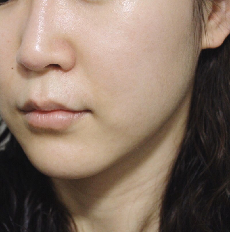 PlusCurrection再生暗疮膏 [SPF38/PA+++)的真实用户使用照片