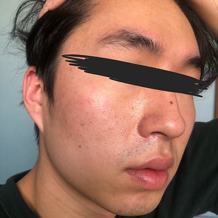 希卡复活霜 2代的真实用户使用照片