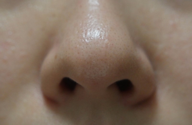 애플린 (APLIN) 올킬 코팩 review image