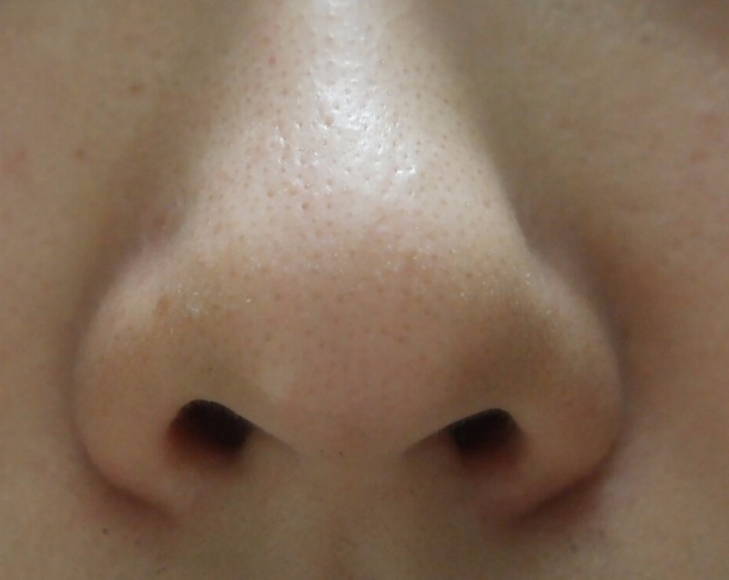 애플린 (APLIN) 올킬 코팩 review image