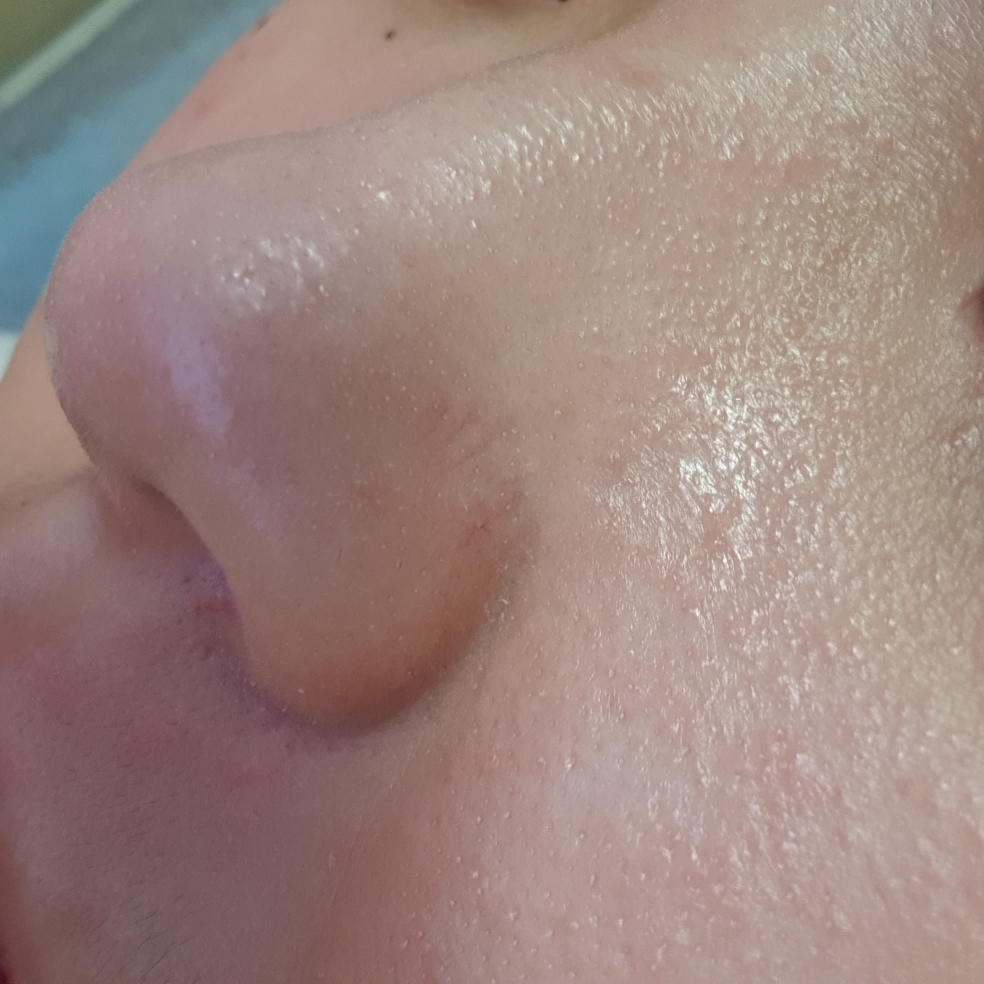 水漾洁面棒的真实用户使用照片