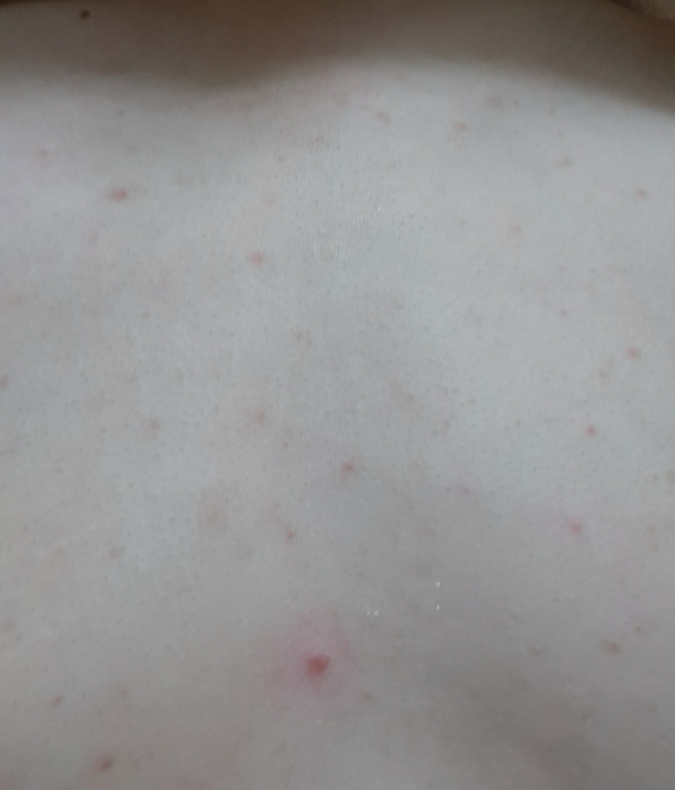 AC Plus 神奇洁面乳的真实用户使用照片