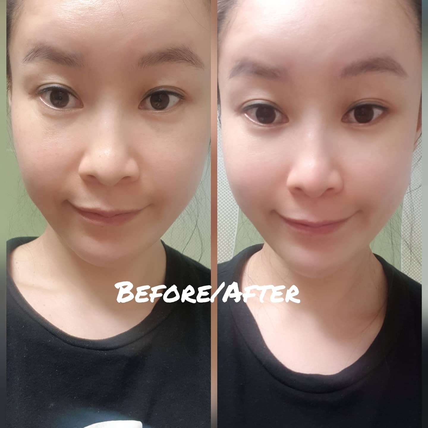 더메디닥터 (TheMediDr.) 카렌듈라 엔자임 필링 젤 review image