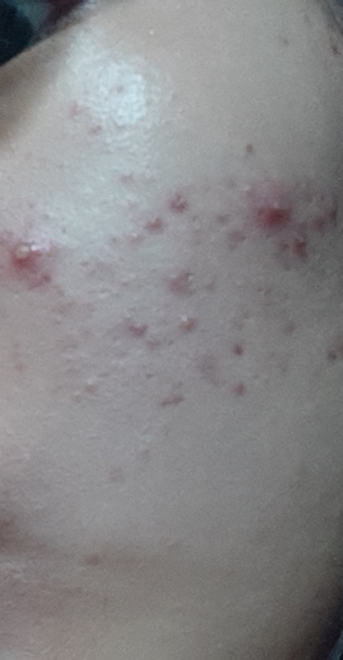 Dr.deep 艾克法洁面泡沫 common.review image