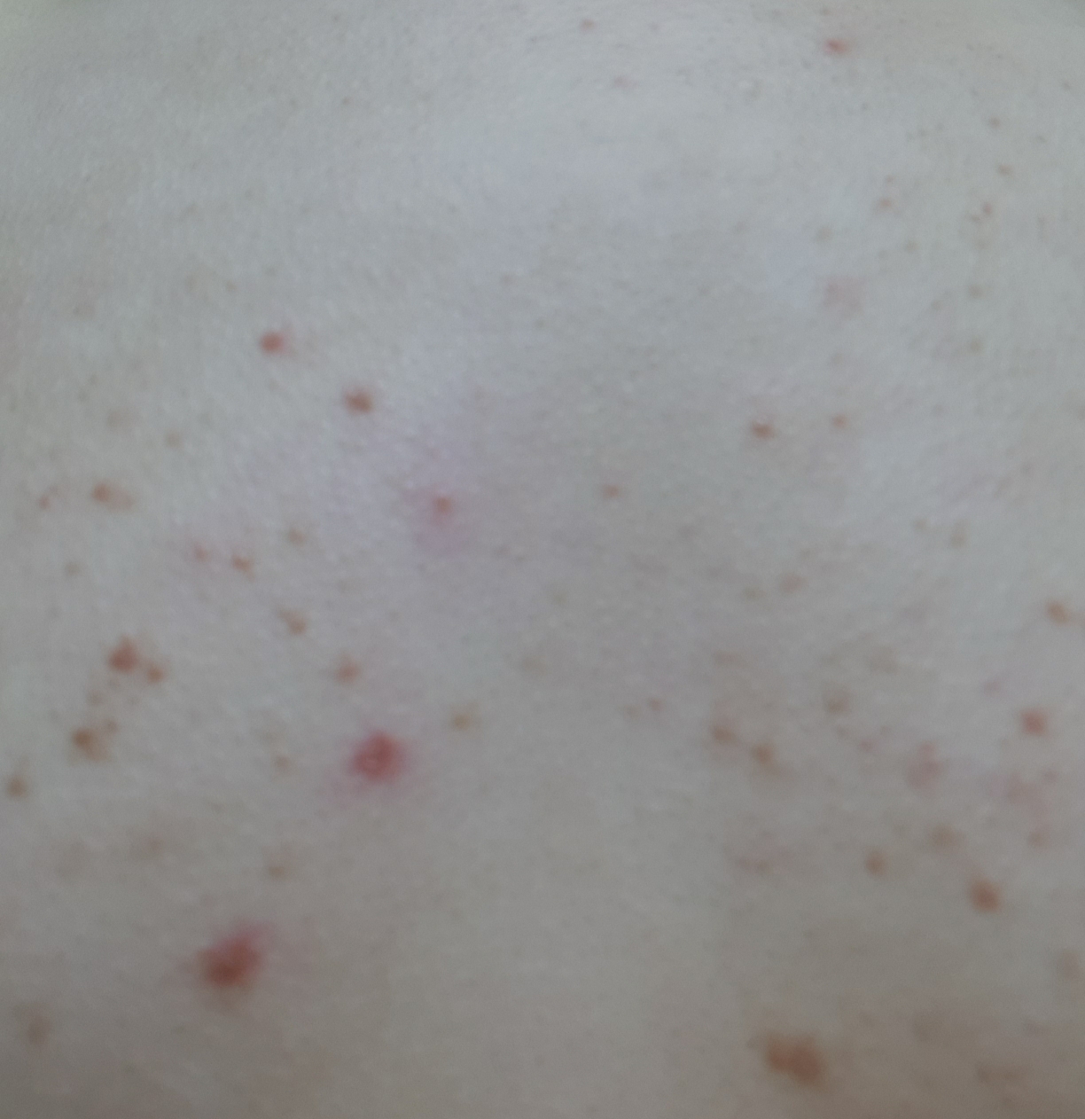 AC Plus 神奇洁面乳的真实用户使用照片