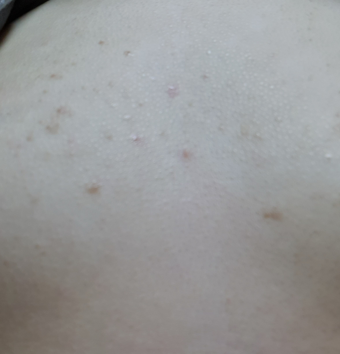 AC Plus 神奇洁面乳的真实用户使用照片