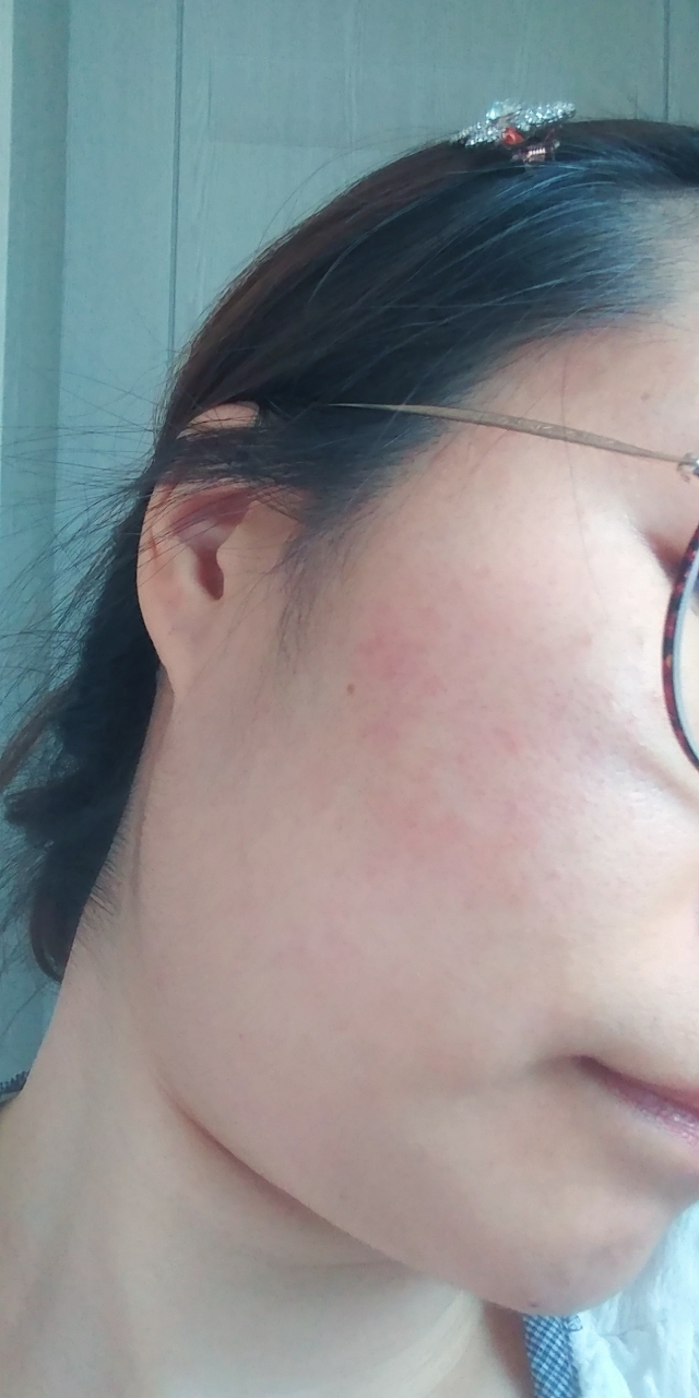 SKINIDEA Epistem Aloe Soothing Gel review image