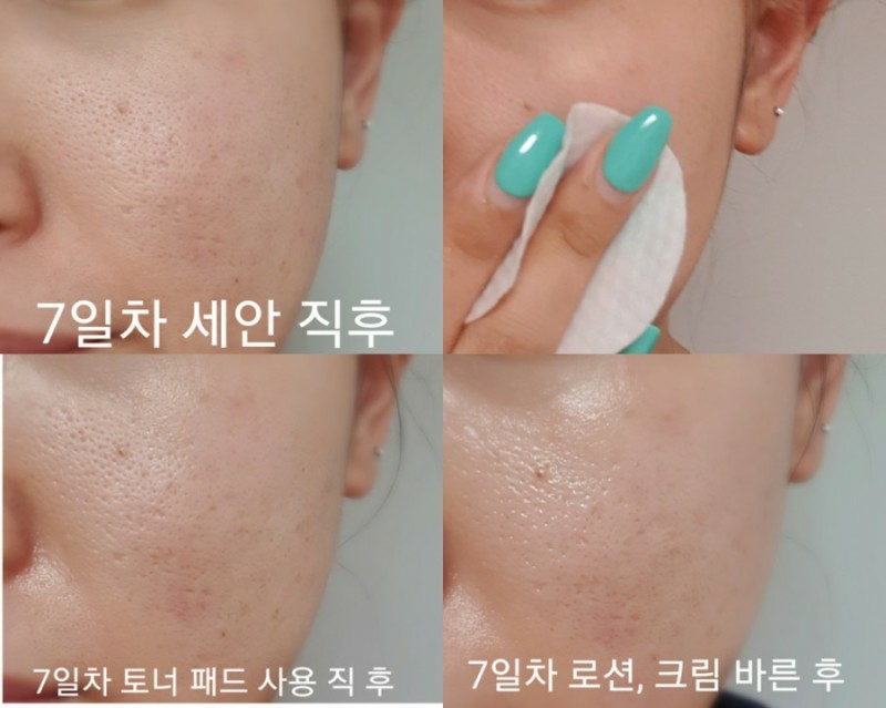 이니스프리 (INNISFREE) 트루케어 PHA 토너 패드 review image