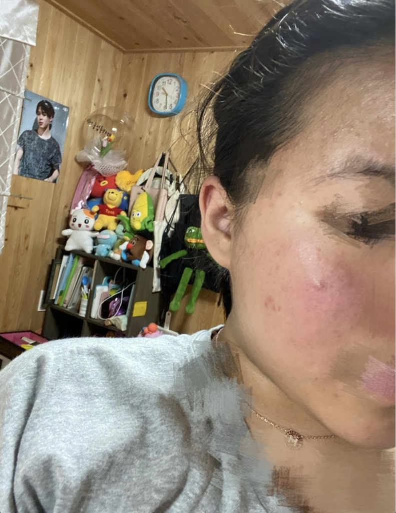 MEDILAB+DERMA Sensitive Barrier Bubble Toner review image