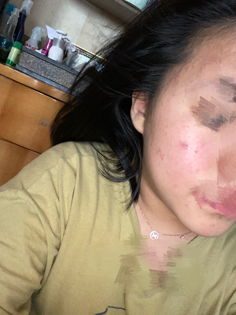 MEDILAB+DERMA Sensitive Barrier Bubble Toner review image