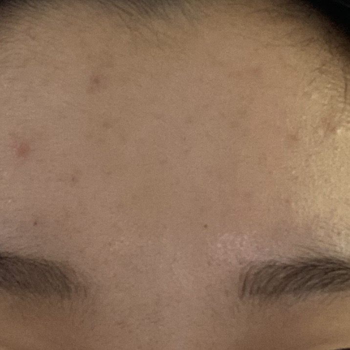 ATOMY A.C. Solution review image