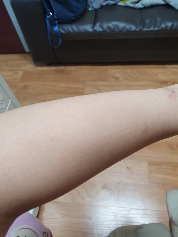 쉐어버터 제모크림 review image