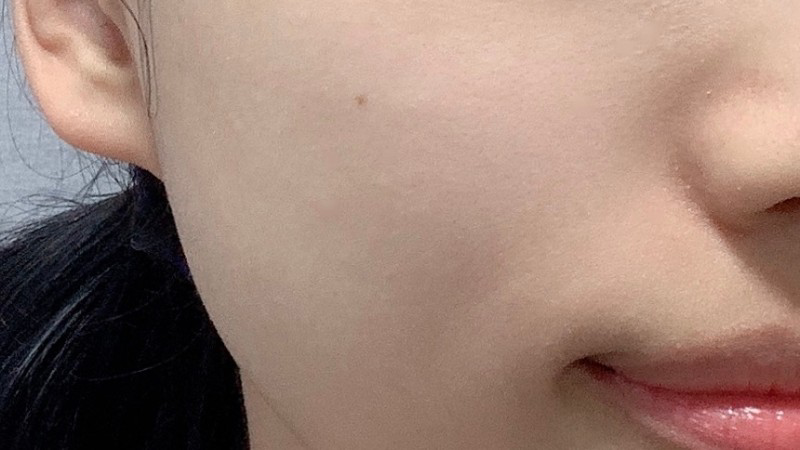 더메디닥터 (TheMediDr.) 카렌듈라 엔자임 필링 젤 review image