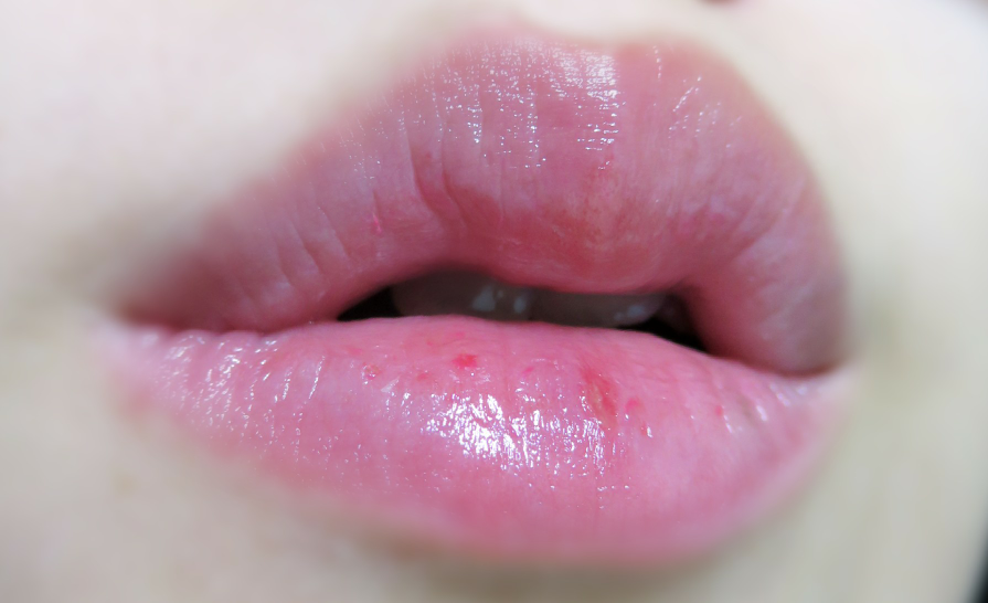 Real user review photo of Sticky Monster Lab Ginger Sugar Lip Balm Stick