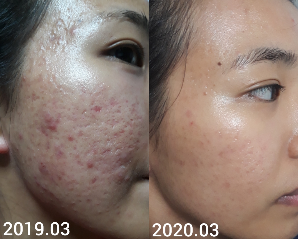 product review image