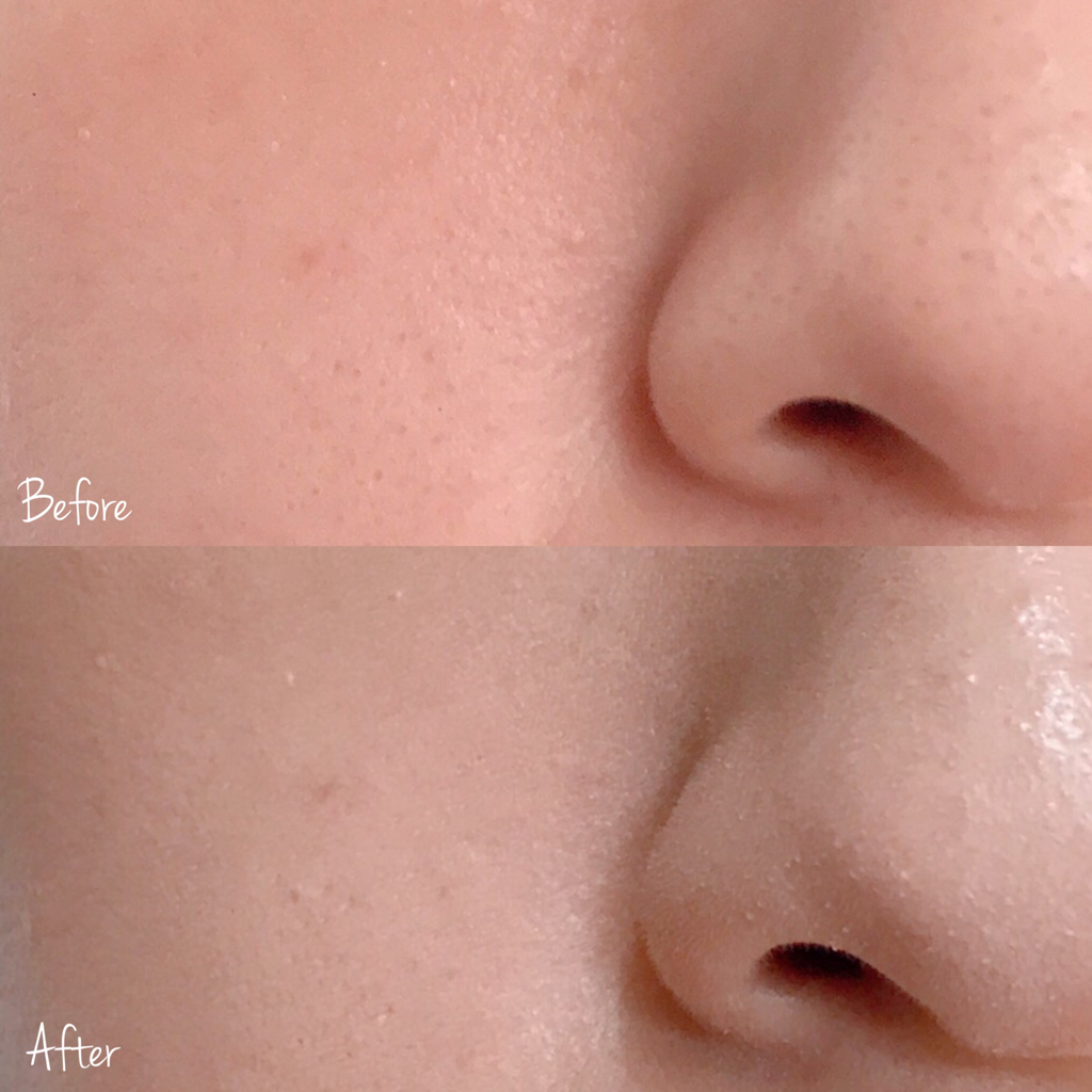 PlusCurrection再生暗疮膏 [SPF38/PA+++)的真实用户使用照片