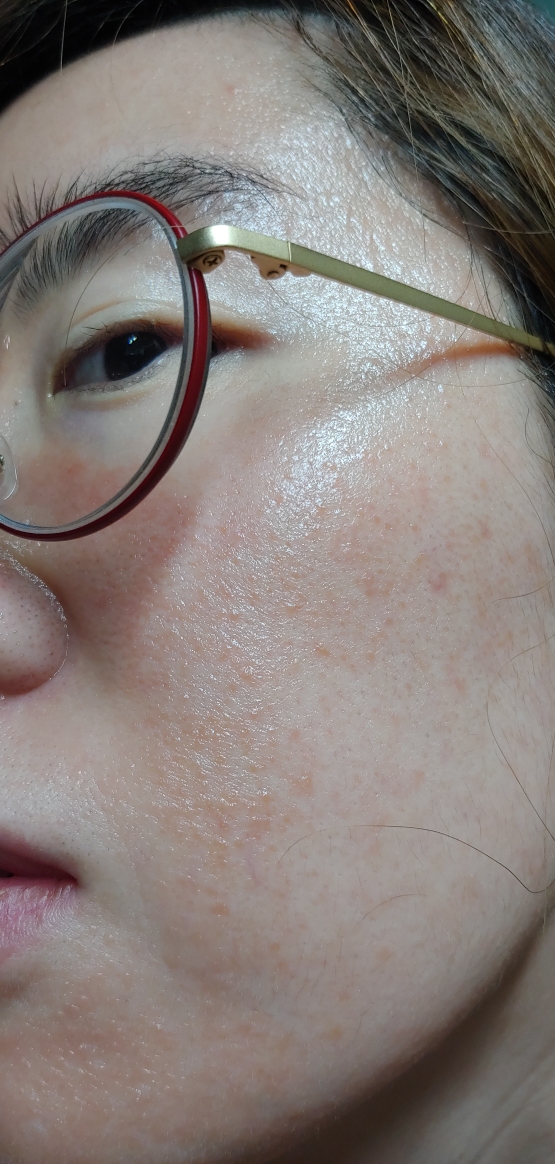 阿尔甘K霜的真实用户使用照片