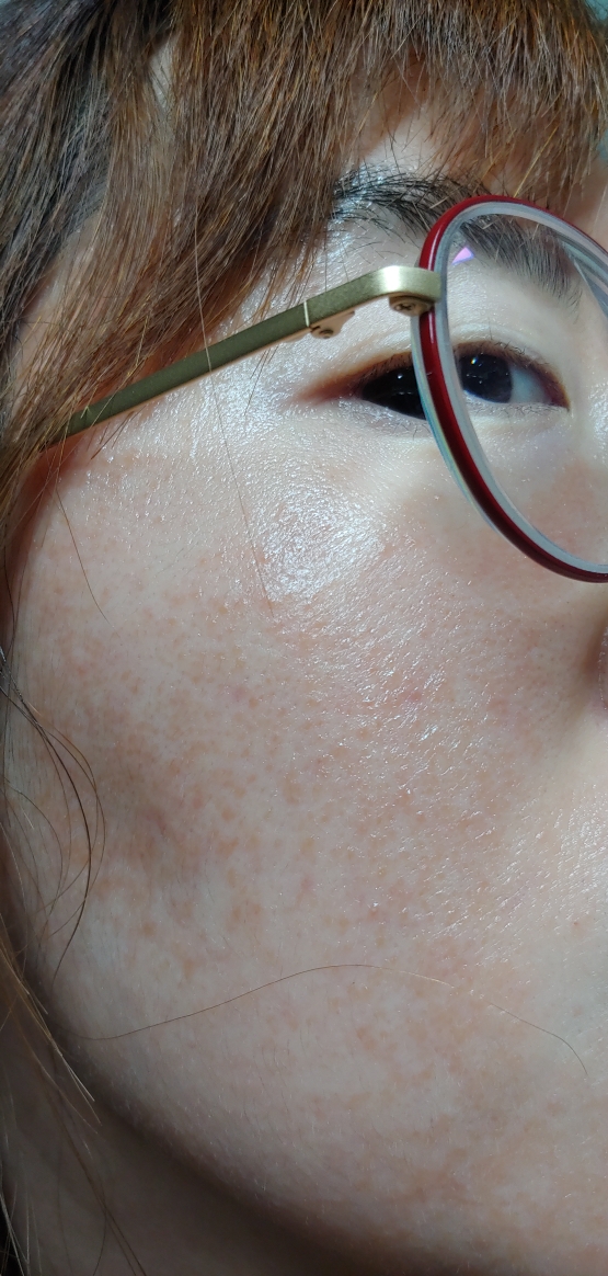 阿尔甘K霜的真实用户使用照片