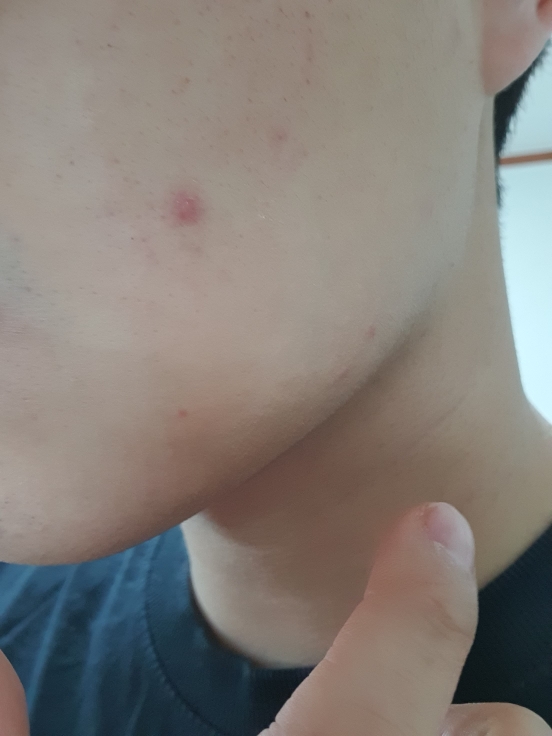 MUH (엠유에이치) 디 이펙티브 블래미쉬 스팟 코렉터 review image