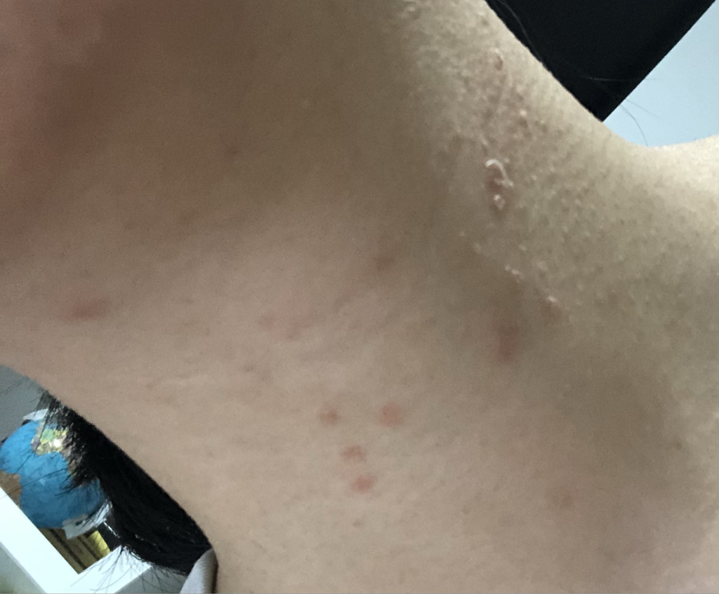 丝绸蛋白质头发去角质2X的真实用户使用照片