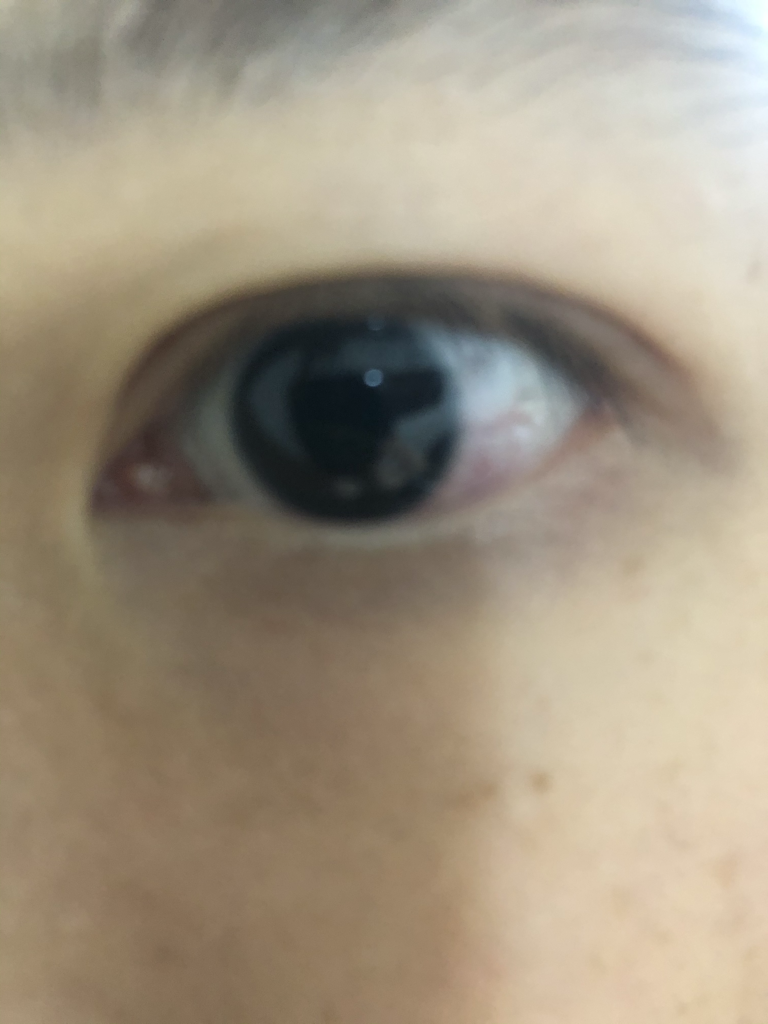 长长的睫毛扩张器 [BK999］的真实用户使用照片