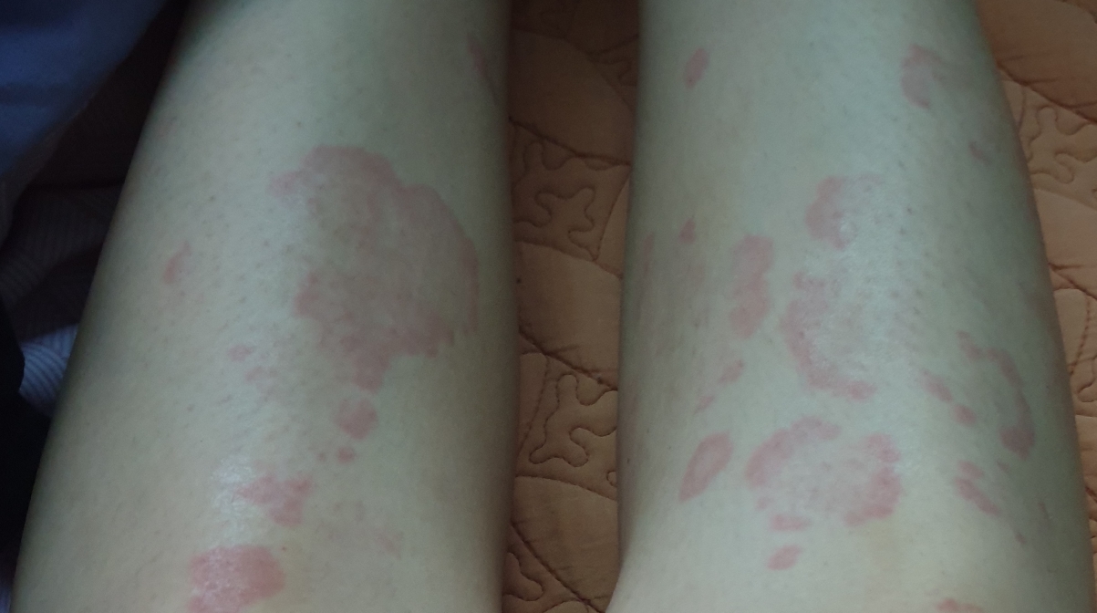 CORTHE 德摩精华冰爽舒缓凝胶 common.review image