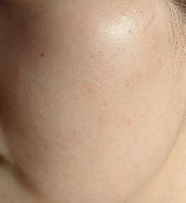 Flucion 17 安瓿瓶的真实用户使用照片