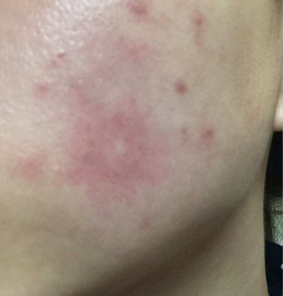 디마르3 (DEMAR3) 플루시온 17 앰플 review image