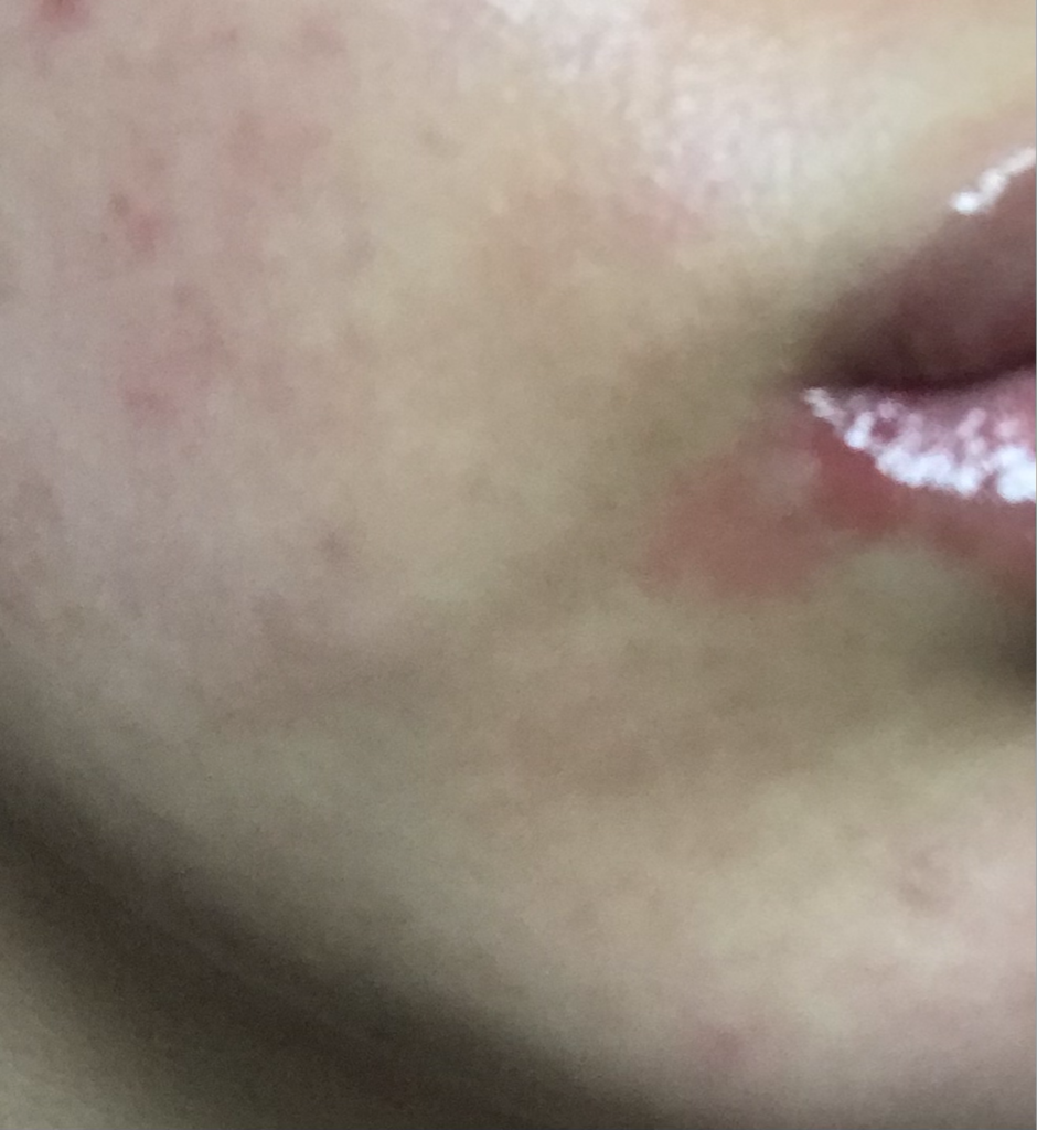 디마르3 (DEMAR3) 플루시온 17 앰플 review image