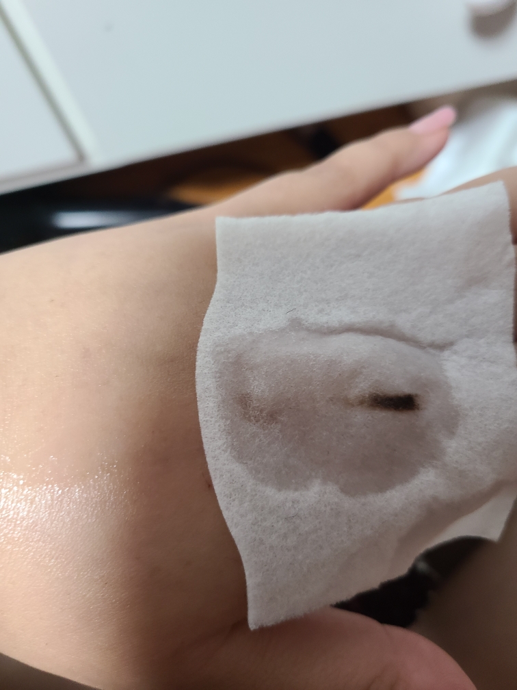 Daily Derma 洁肤水温和添加剂的真实用户使用照片