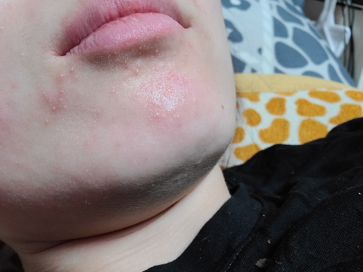 닥터에스떼알엑스 (Dr.estheRx) 리얼 에센셜 고트밀크필 프로그램 4WEEK review image