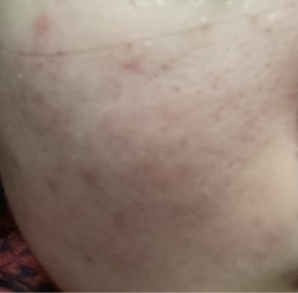 秘密解决方案面膜的真实用户使用照片