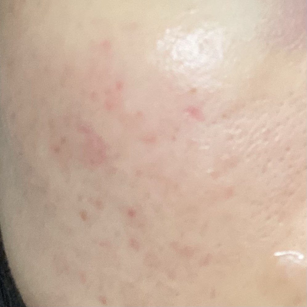 秘密解决方案面膜的真实用户使用照片