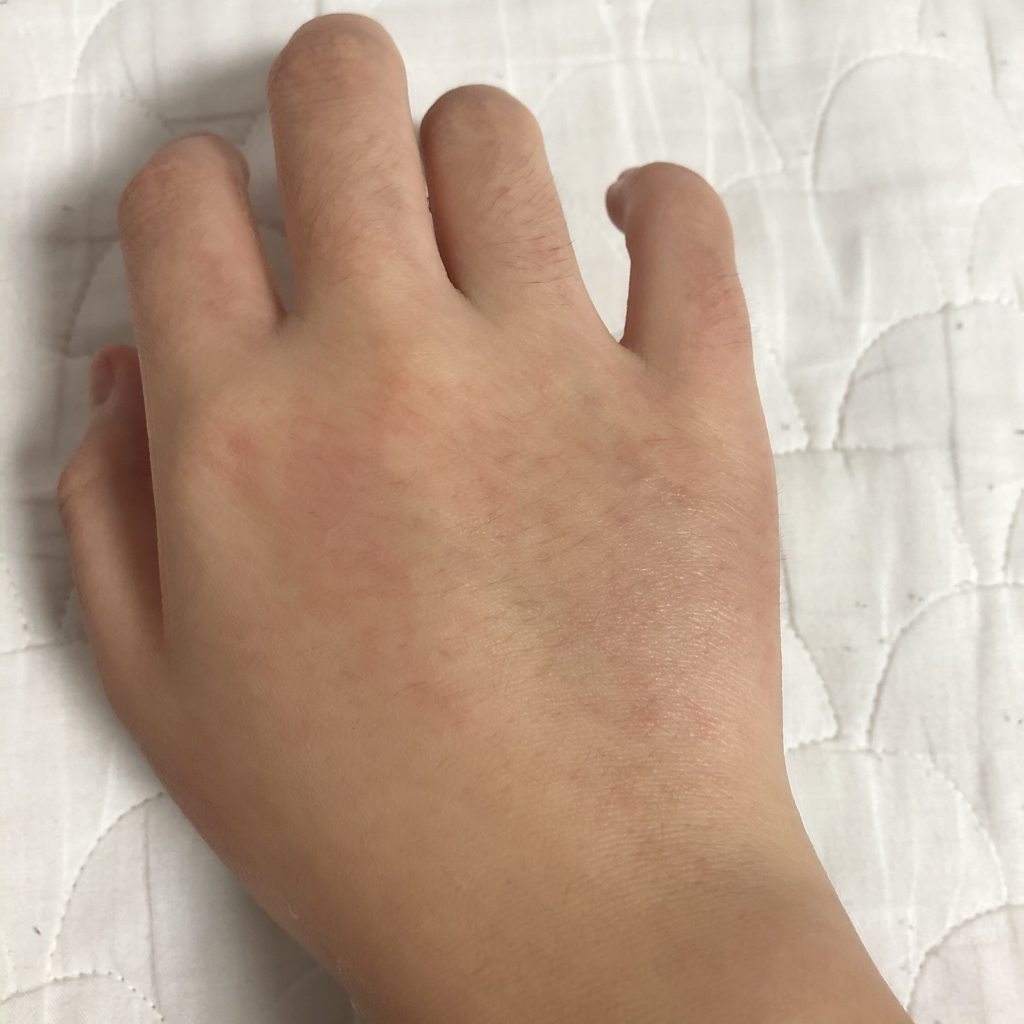 纯净之花 净化肌肤的真实用户使用照片