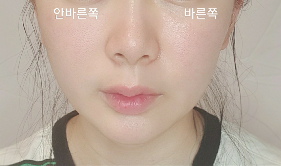 Flucion 17 crème的真实用户使用照片