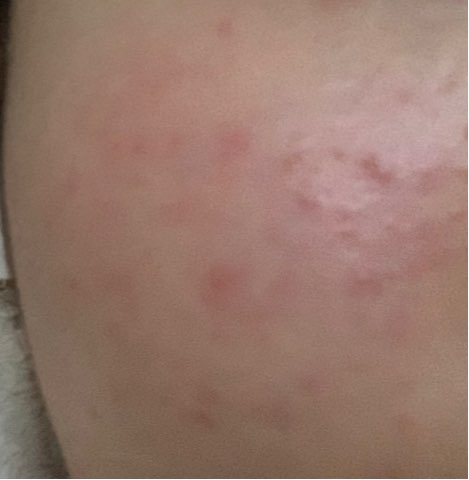 바이크림 (bycream) 압타민 C 미라클 마스크 review image